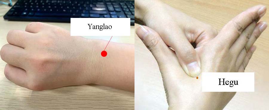 acupressure acne 1